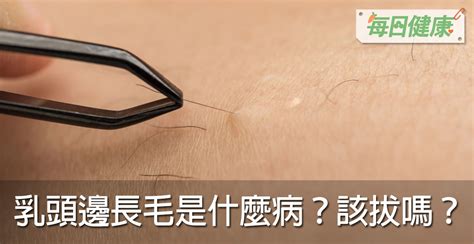 乳頭生毛|乳頭邊長了毛，是什麼病？該不該拔？讓名醫一次解釋給您聽｜每